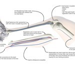 Soft Tissue Leg Trainer Renderings