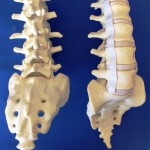 L1-S1 Workshop Cortical Cancellous Brittle Silicone Discs with Lateral Ligaments